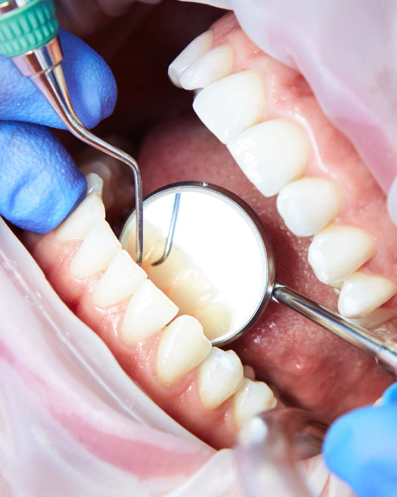 $189 New Patient Special Offer