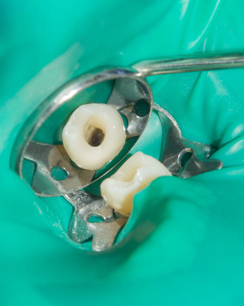 Do you have tooth pain? Let us inspect and treat your tooth