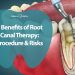 Benefits of Root Canal Therapy