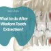 What to do After Wisdom Tooth Extraction?