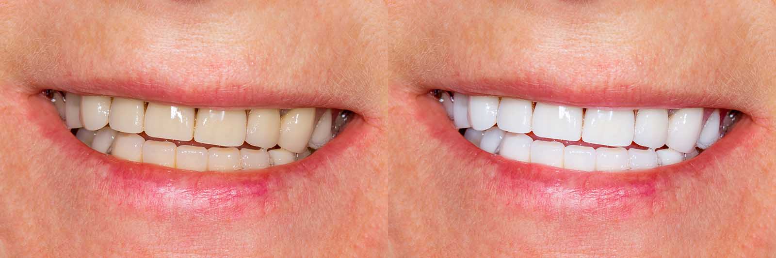 Cosmetic dentist on the Gold Coast