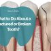 What to Do About a Fractured or Broken Tooth?