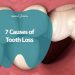7 Causes of Tooth Loss - Dentists in Ormeau