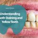 understanding tooth staining and yellow teeth